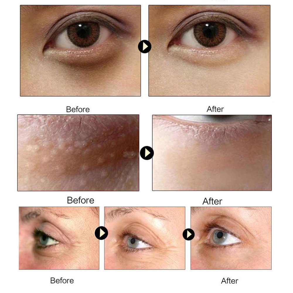 Gold Collagen Eye Mask - Image 3